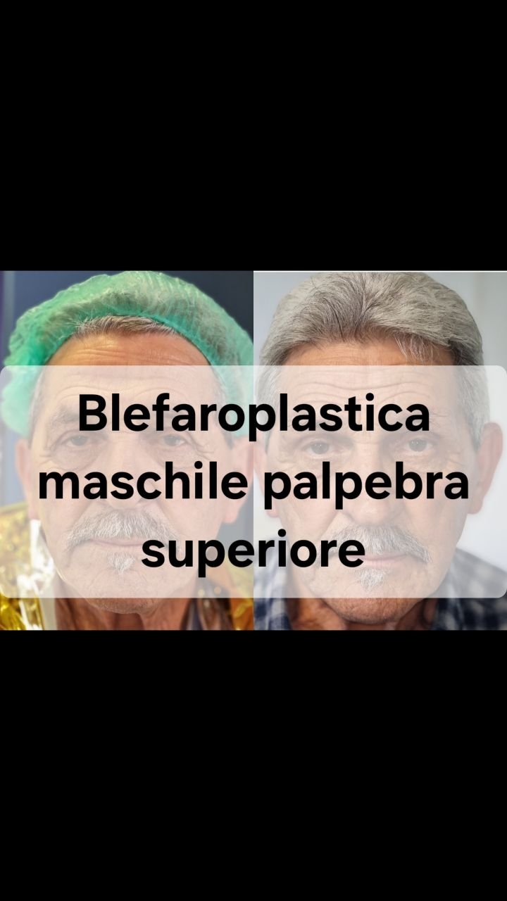 Anteprima del reel: Crollo del sopracciglio