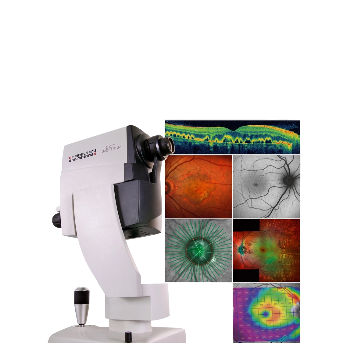 Esame OCT — analisi macula, glaucoma, maculopatia