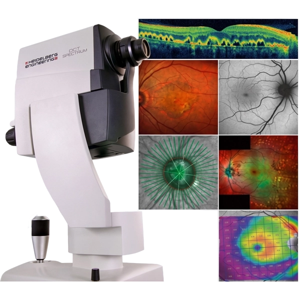 Esame OCT — analisi macula, glaucoma, maculopatia