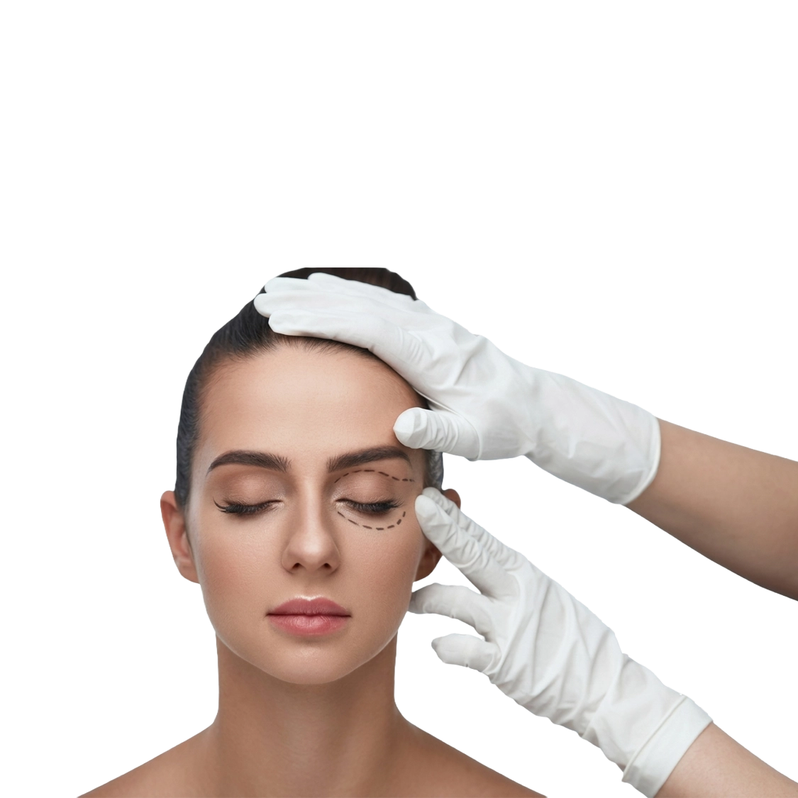 Tossina botulinica oculo-palpebrale — botox, rughe, lifting sguardo