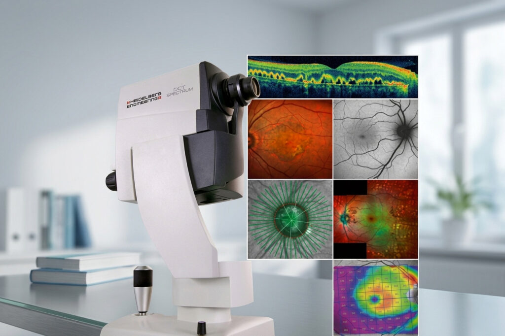Strumento OCT con immagini della retina, della macula e del nervo ottico
