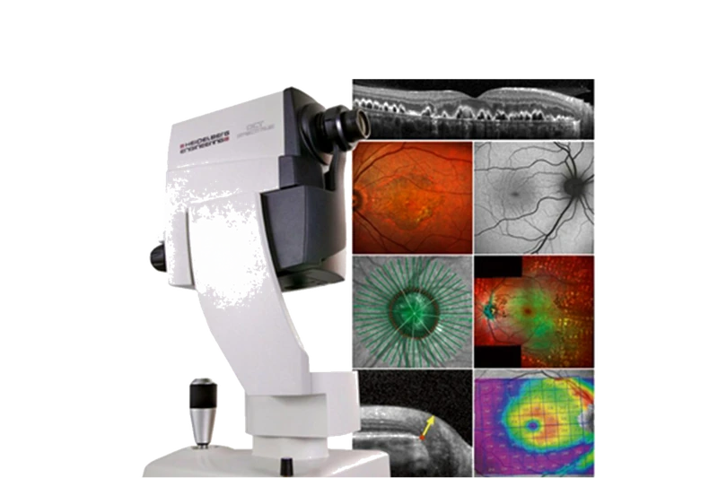 Strumenti e immagini di diagnostica oculare OCT